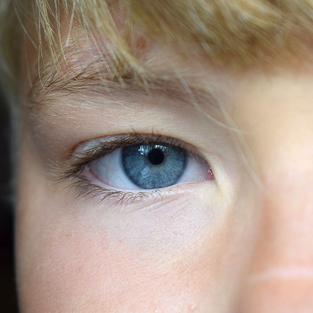 Autoimmune Disease And Vision Dublin CA Iron Horse Optometric Group